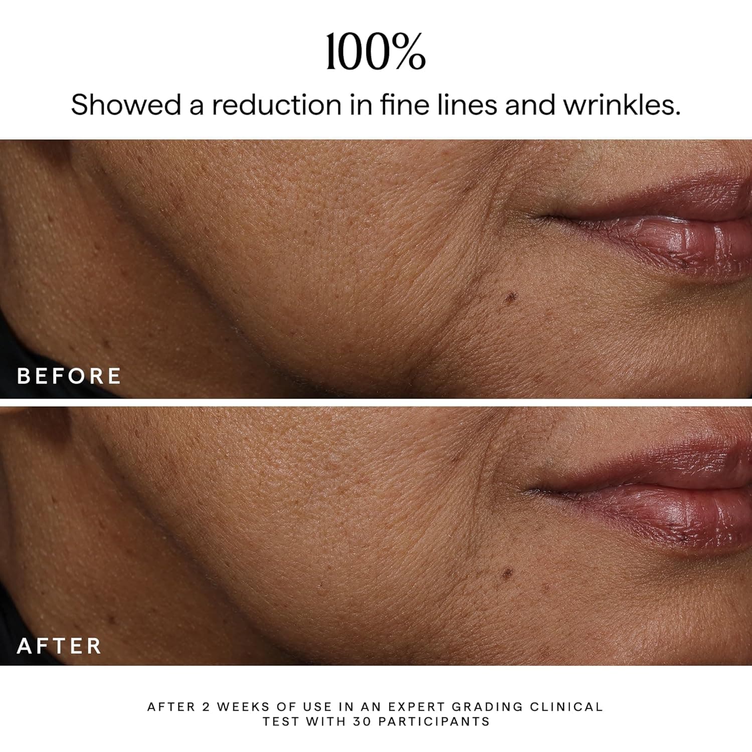 Herbivore Bakuchiol Dual-Retinol Alternative Face Serum thumbnail 4